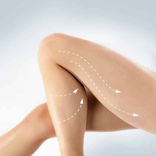 Z-Wave Cellulitis Treatment Special