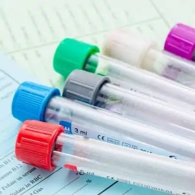 test tubes square